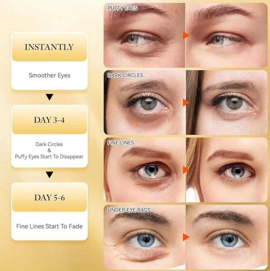 24K Gold Hydrogel Under Eye Patches – Dark Circles & Puffiness Relief