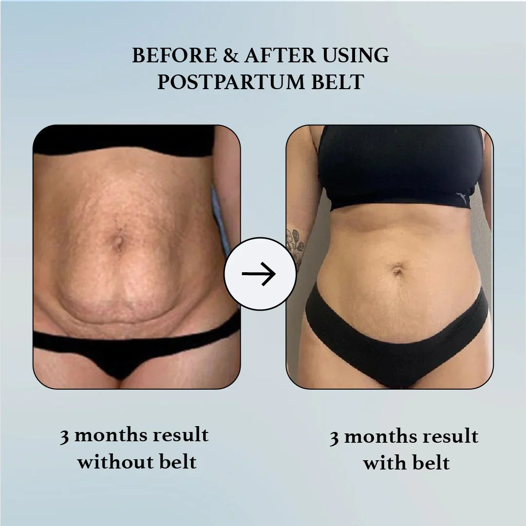 The 3-in-1 postpartum support system